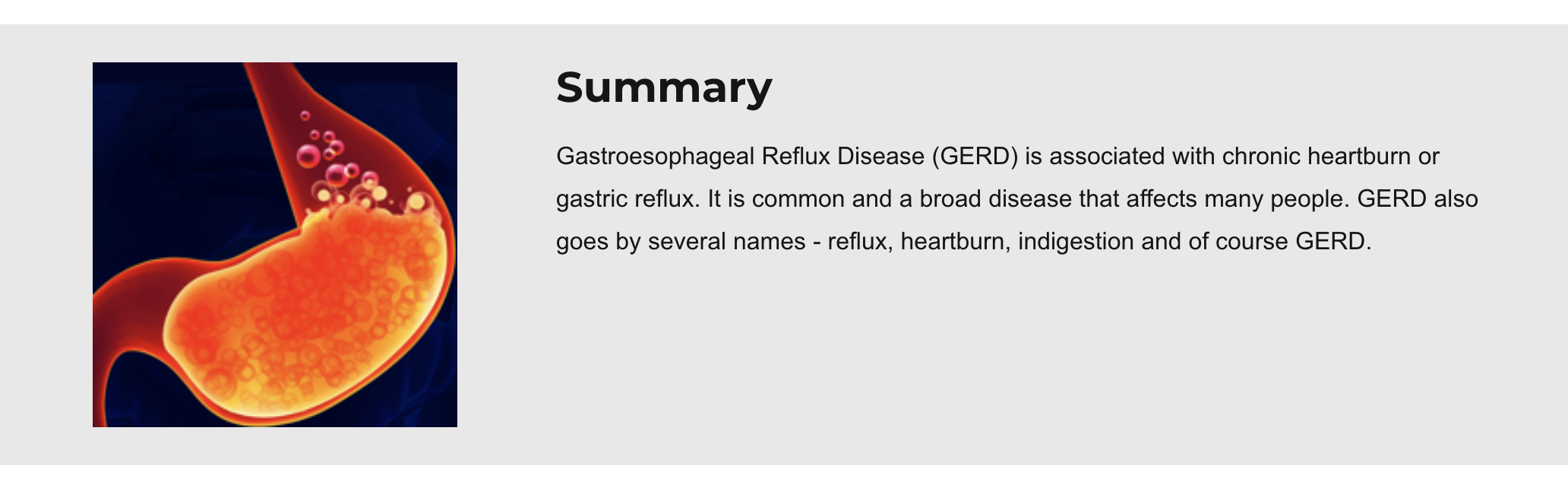 TCM Vs. Gastric Reflux